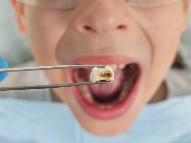 Best Emergency Treatment for Jaw Pain or Injury in Lincoln Rk, PA